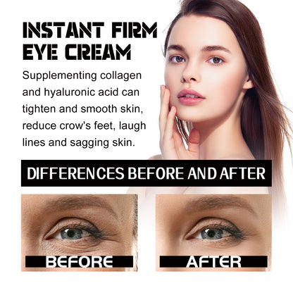 EELHOE Eye Firming Cream for Wrinkles and Hydration
